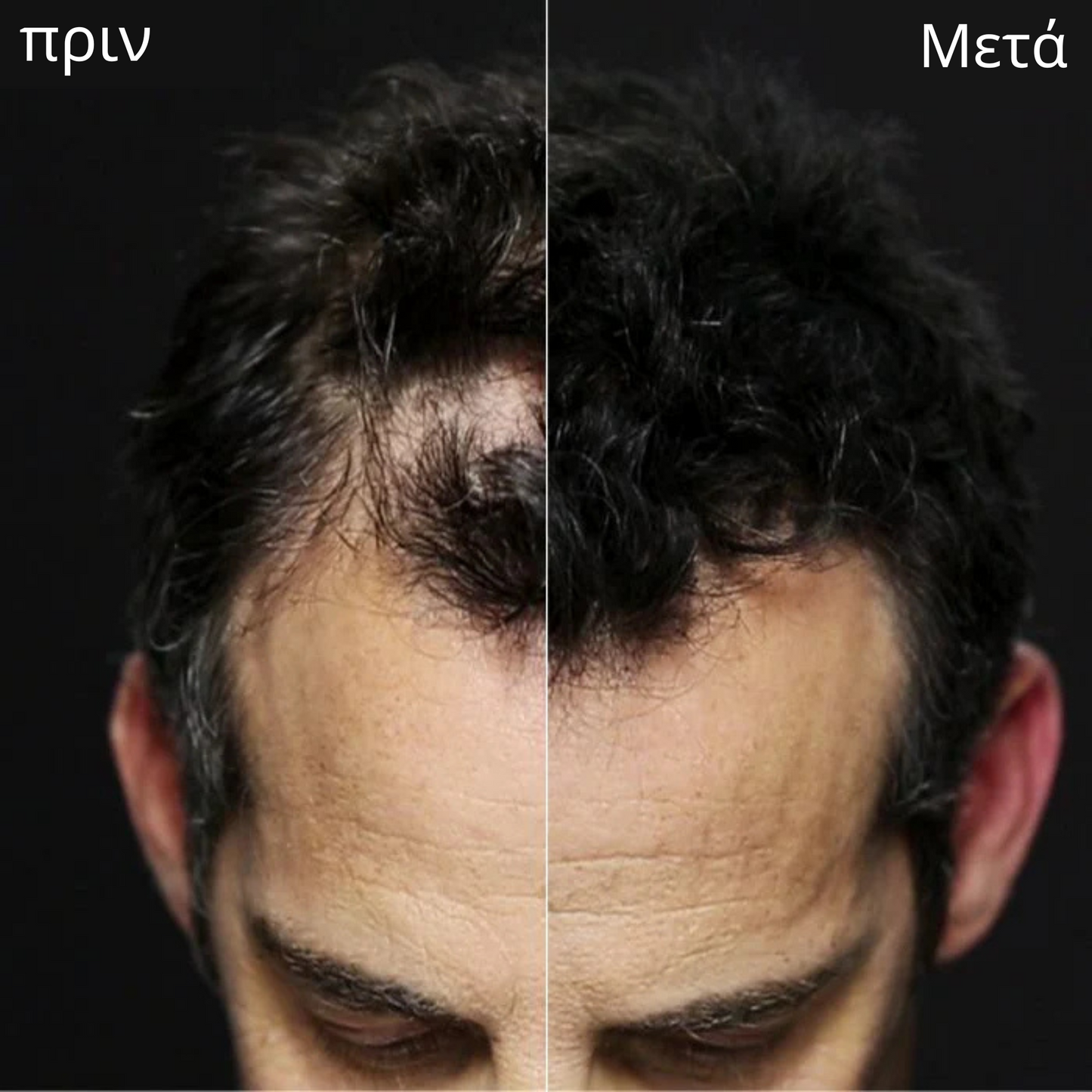 Οι ίνες άμεσης πύκνωσης μαλλιών της Toppik + ΔΩΡΕΑΝ δώρο