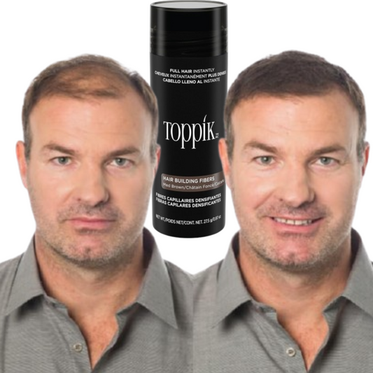 Οι ίνες άμεσης πύκνωσης μαλλιών της Toppik + ΔΩΡΕΑΝ δώρο